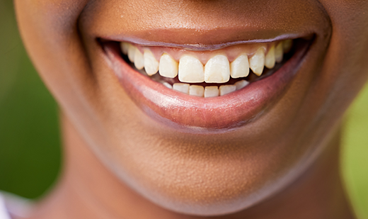 Smile