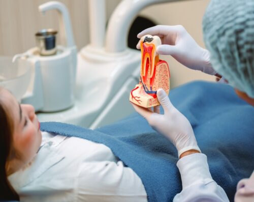 Dentist showing root canal procedure to patient