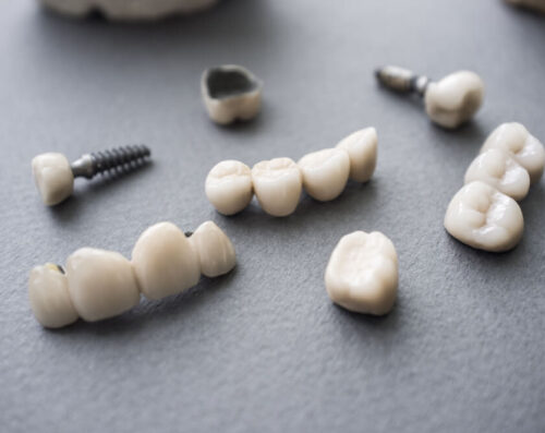 mouth reconstruction service