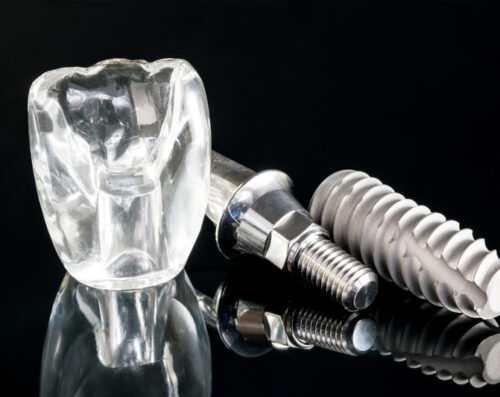 Close-up dental implant model on a black glass table and background.