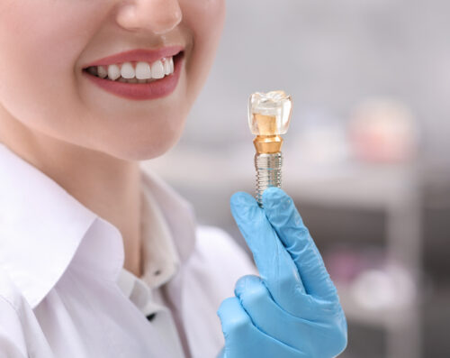 Dentist holding educational model of dental implant indoors, closeup.