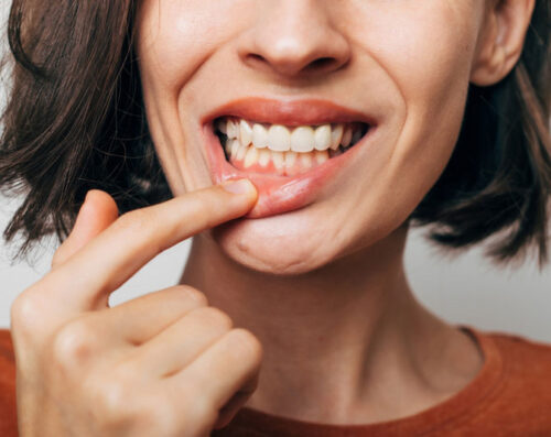 Close-up of a woman pulling down her lower lip to show her gums and teeth for a dental health checkup.