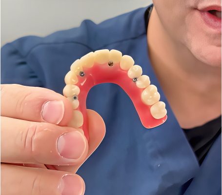 Implant-supported dentures