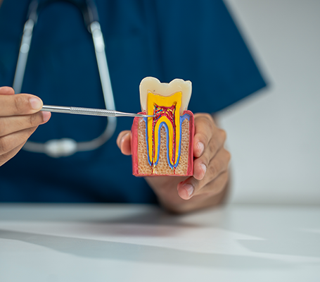 Implant-supported dentures