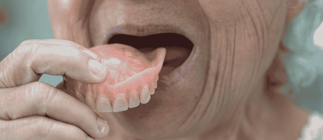 loose dentures problems