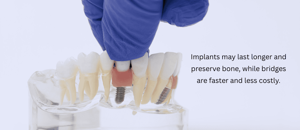 Choosing a Restoration That Fits Your Mouth