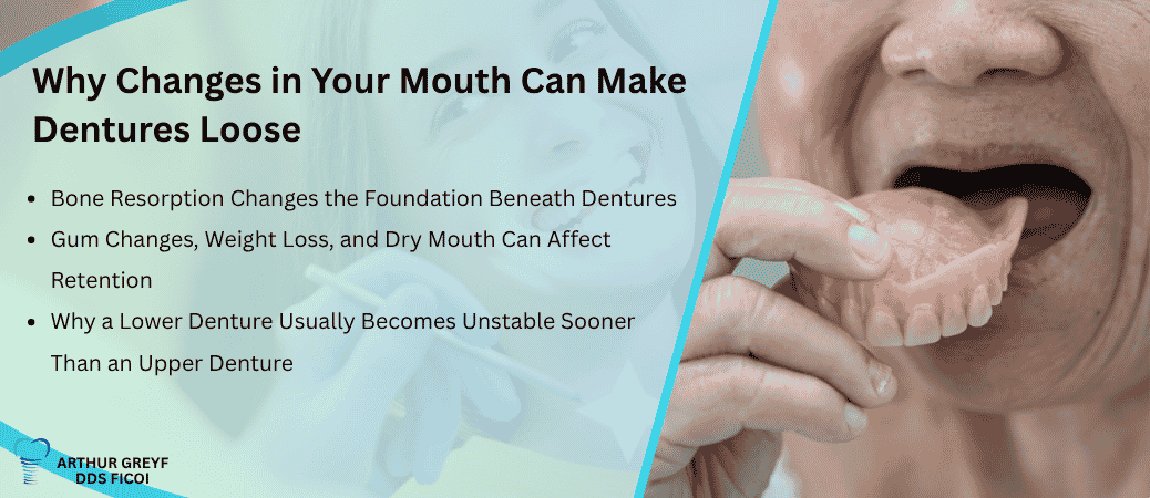 How Changes in Your Mouth Undermine Denture Fit