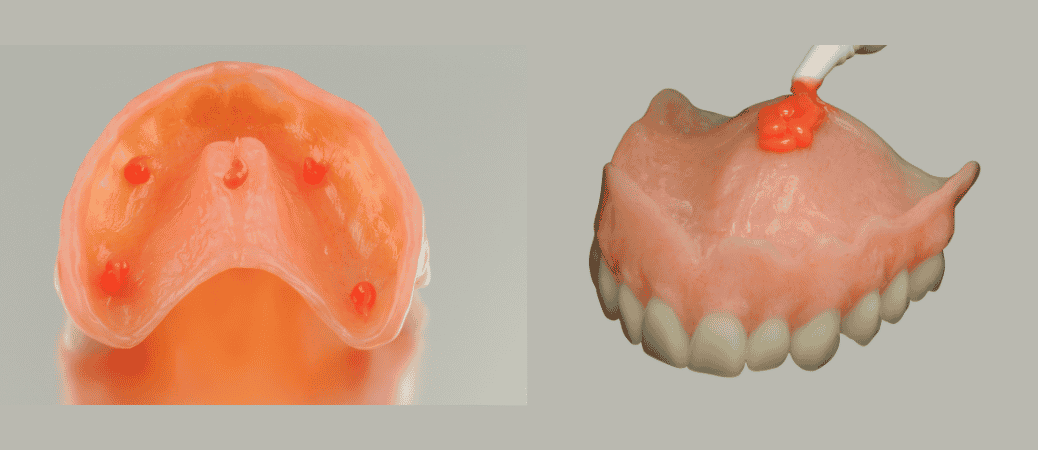 denture adhesive problems